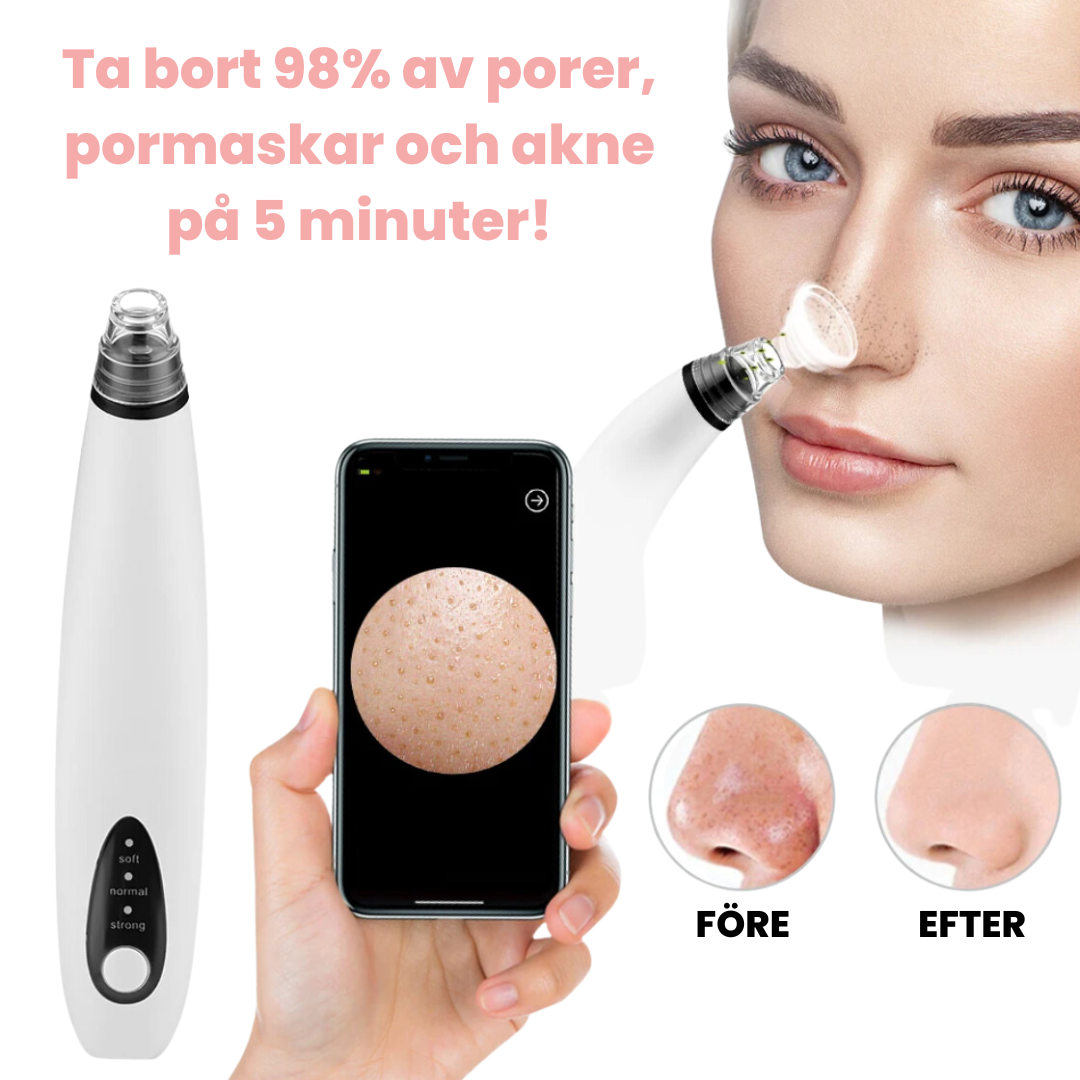 PoreVanish™ | Pore removal machine