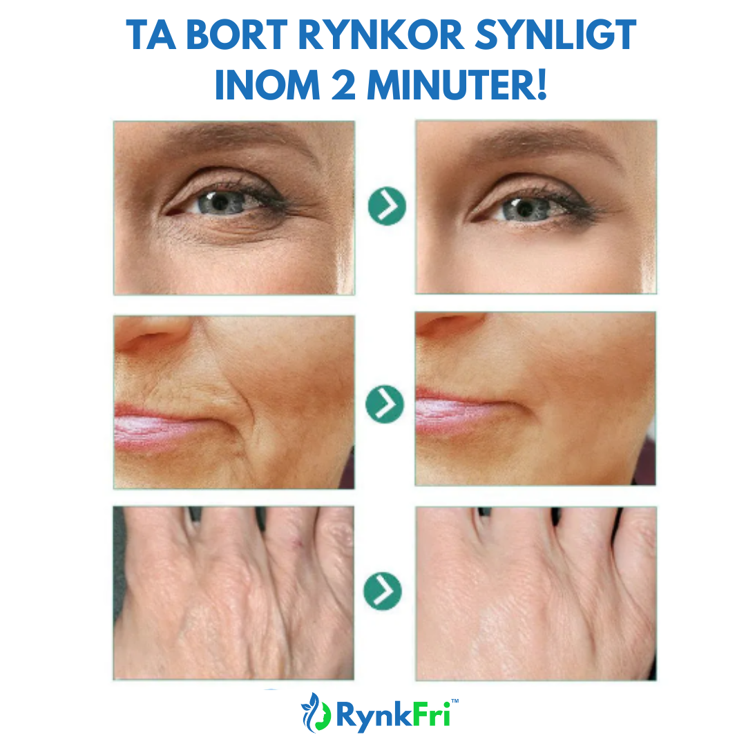 RynkFri™ | Anti-Aging Face Cream